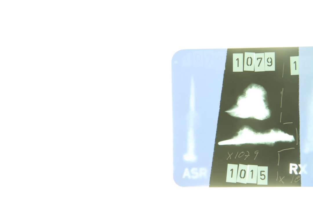 Kistes�m, samt to stumper?. 