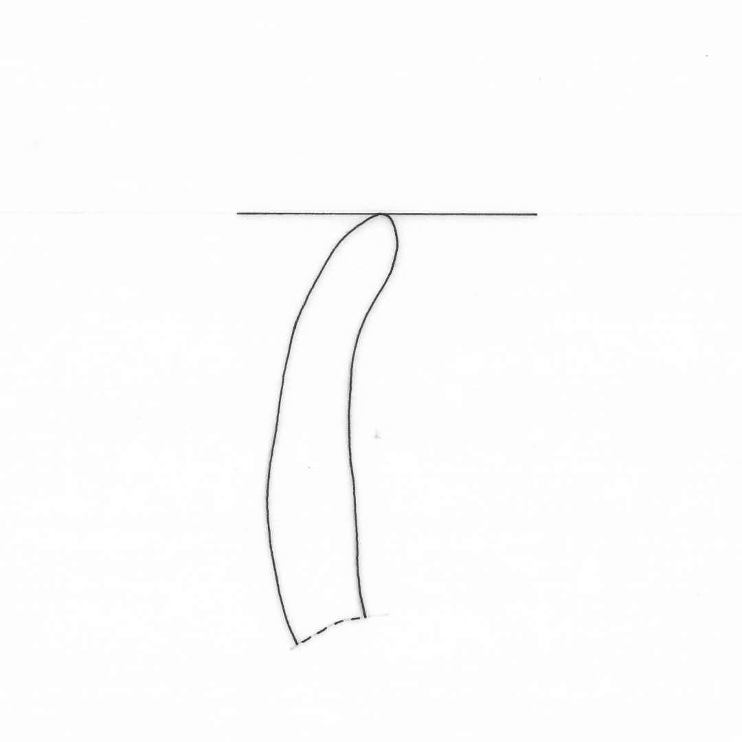 2 mundingsrandsk�r antagelig fra samme kar med glat indadb�jet rand af brungr�t, magret lergods. Gr. 4.